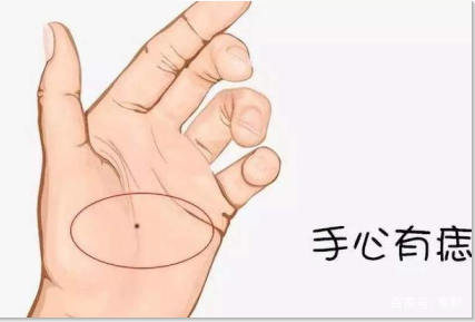 掌心痣是福是祸,看完这三点,再决定要不要点痣 掌心痣是福是祸,看完这三点,再决定要不要点痣
