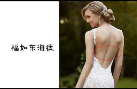 背上有痣好不好，背上长痣有什么说法？