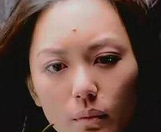 痣的位置代表什么意思