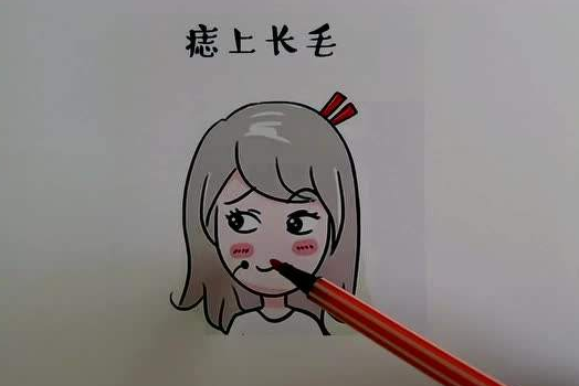 有毛的痣好吗 有毛的痣好吗