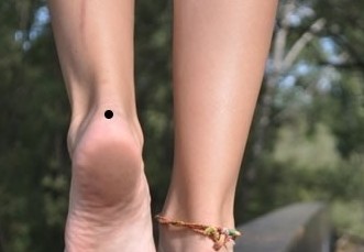女人全身痣相图解【真人全身痣相图解】