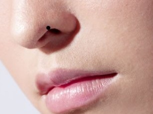 女人全身痣相图解【真人全身痣相图解】
